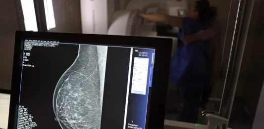 Nova lei reforça direito a três folgas por ano para exames preventivos