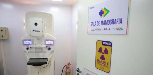 Cirurgias de mama no SUS crescem 50% em 10 anos